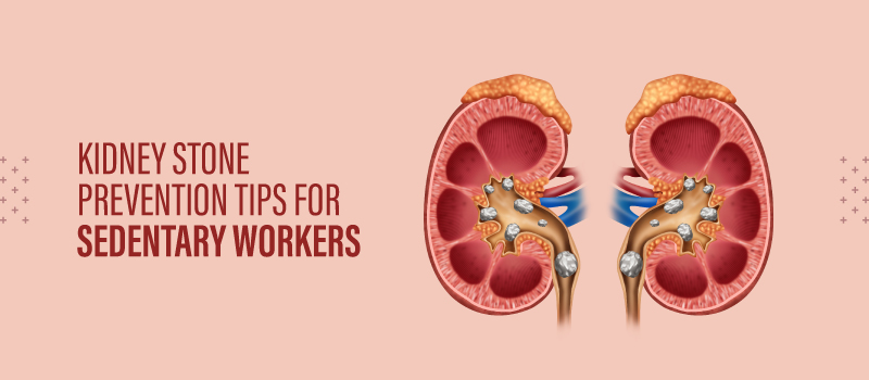 Kidney Stone Prevention Tips for Sedentary Workers