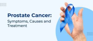 Prostate Cancer: Symptoms, Causes and Treatment
