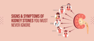 Signs & Symptoms of Kidney Stones You Must Never Ignore