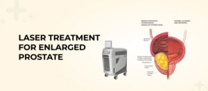 Laser Treatment For Enlarged Prostate