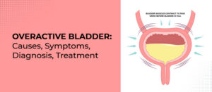 OVERACTIVE BLADDER: Causes, Symptoms, Diagnosis, Treatment