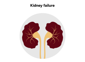 Kidney Failure