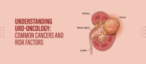 Understanding Uro-Oncology: Common Cancers and Risk Factors