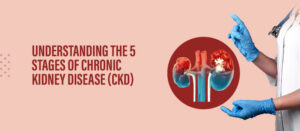 Understanding Chronic Kidney Disease (CKD): Symptoms, Stages, and Treatment Options